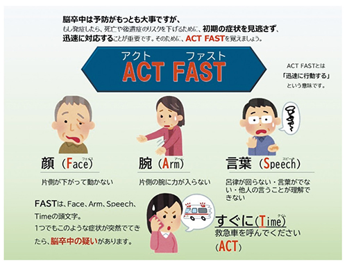 脳卒中FASTテスト